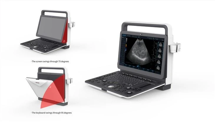 Portable Color Doppler Ultrasonic System